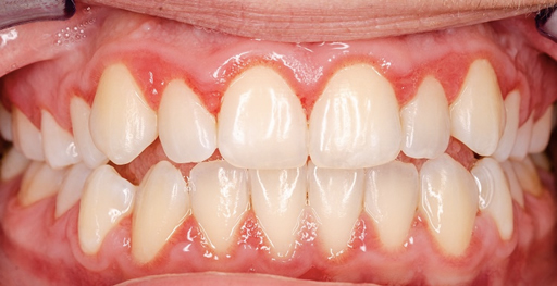 Periodontia